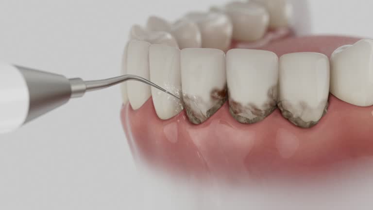 Trusted Teeth Cleaning And Checkup service in Highland Springs, VA - Dentist Open Now